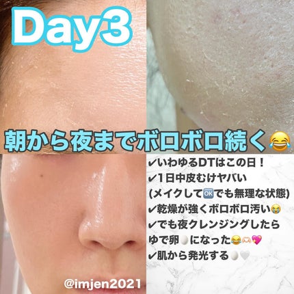 ダーマスキンピーリング/BQCELL/その他キットセットを使ったクチコミ(6枚目)