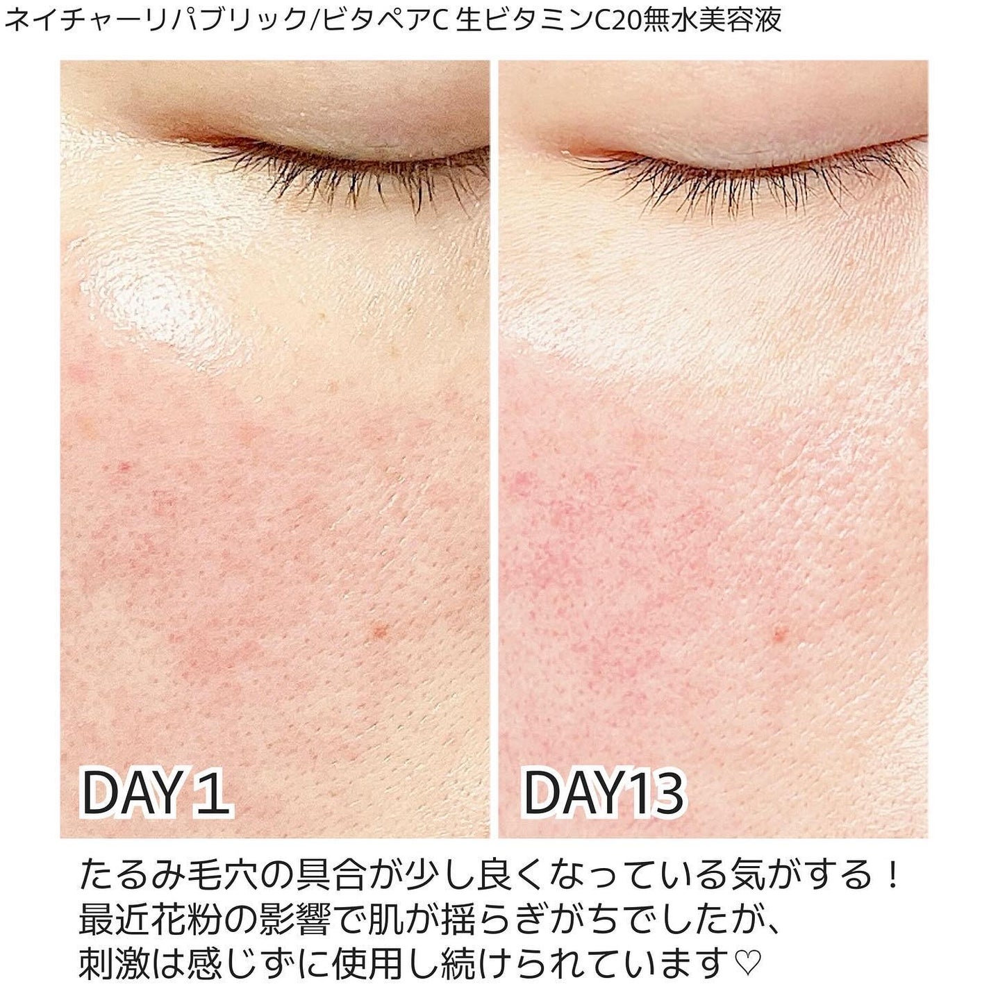 ビタペアC ビタレチ美容液/ネイチャーリパブリック/美容液を使ったクチコミ(2枚目)