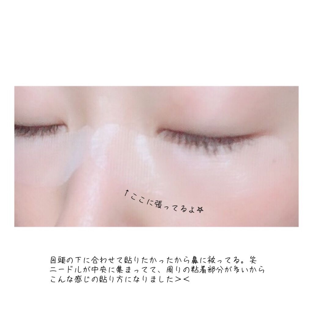 リクエス コンセントレート チャージ パッチ/クラブ/シートマスク・パックを使ったクチコミ(4枚目)