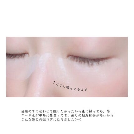 リクエス コンセントレート チャージ パッチ/クラブ/シートマスク・パックを使ったクチコミ(4枚目)