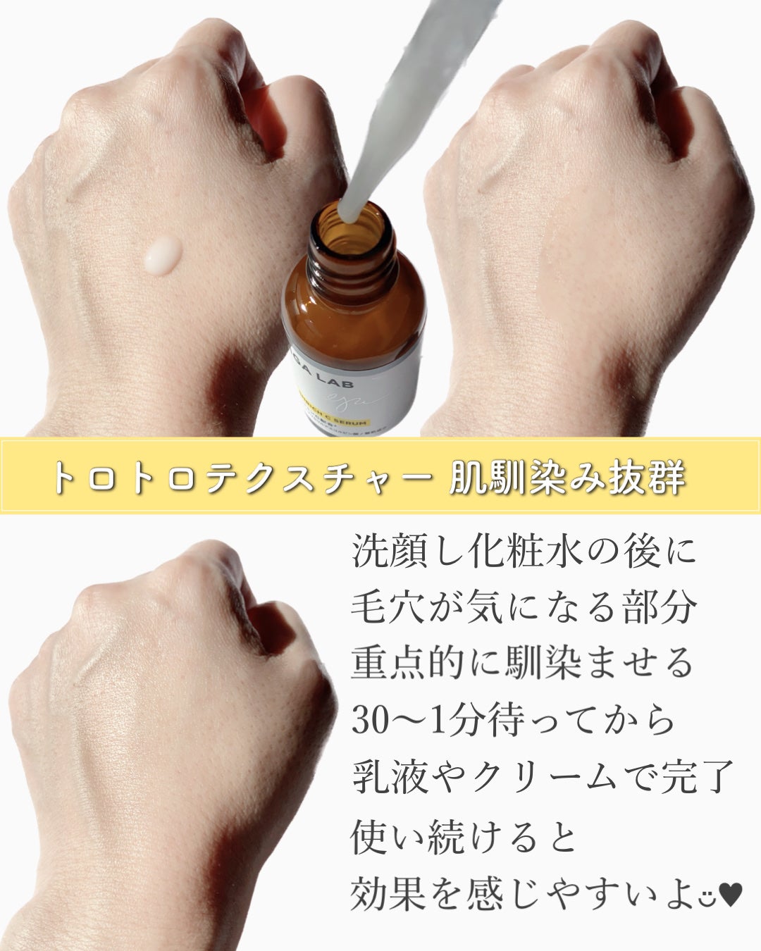 エンリッチCセラム/IGA LAB/美容液を使ったクチコミ(3枚目)