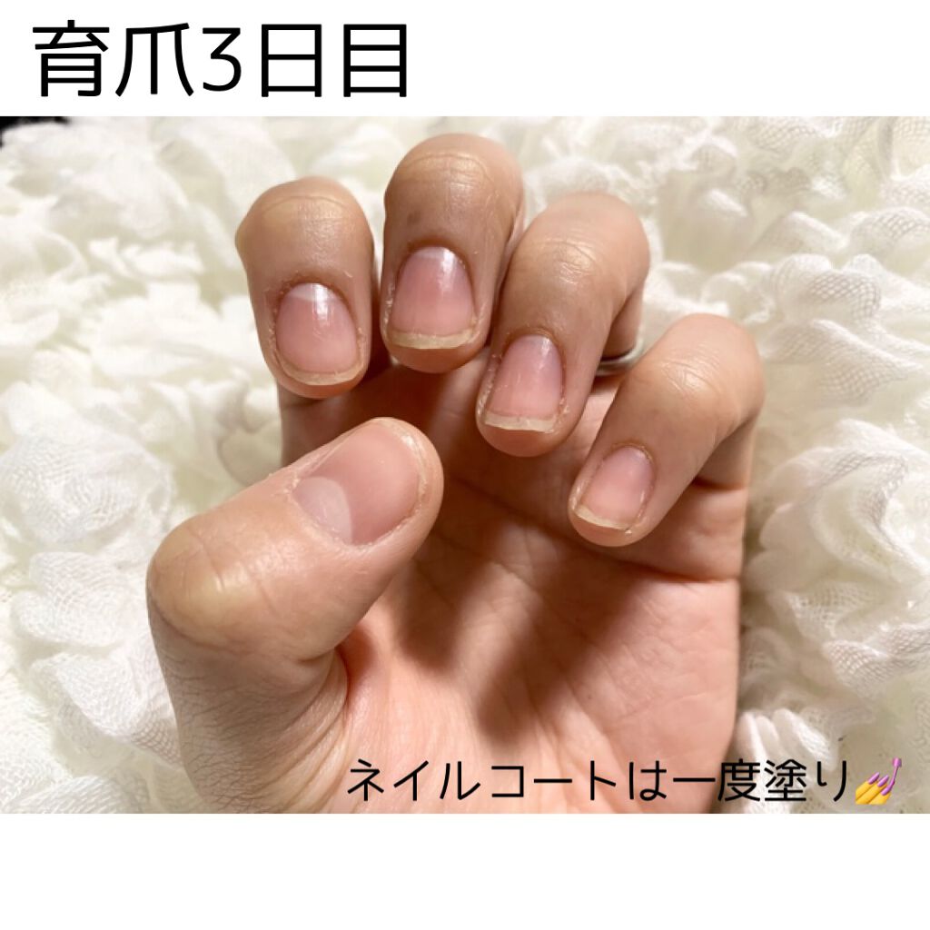 エテュセ クイックケアコート/ettusais/ネイルオイル・トリートメントを使ったクチコミ（3枚目）