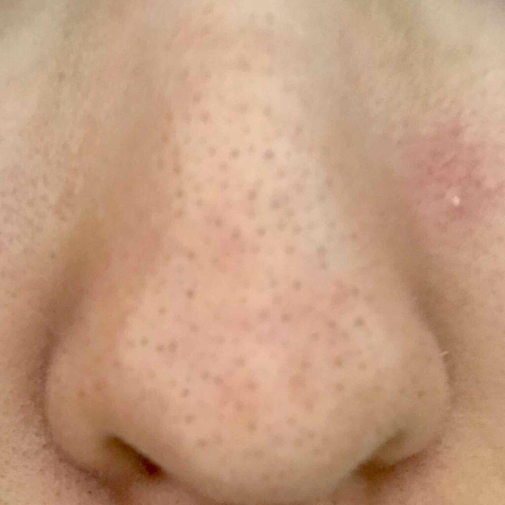 7 day Special Set プログラム4/b.glen/トライアルキットを使ったクチコミ(2枚目)