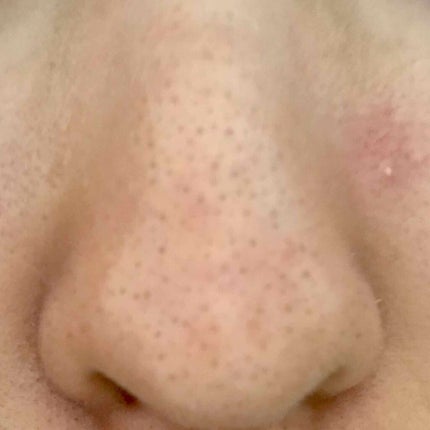 7 day Special Set プログラム4/b.glen/トライアルキットを使ったクチコミ(2枚目)