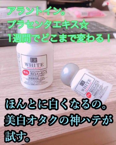 コスモホワイトニングローションV(薬用美白化粧水)/DAISO/化粧水を使ったクチコミ（1枚目）