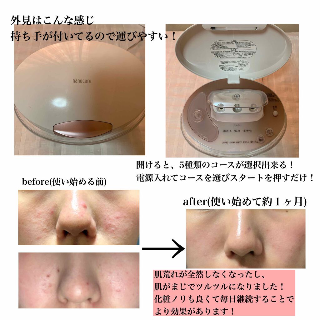 スチーマー ナノケア/Panasonic/美顔器・マッサージを使ったクチコミ(2枚目)