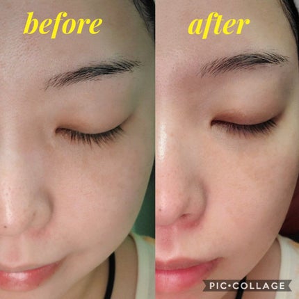 ネイチャーコンク 薬用クリアローション/ネイチャーコンク/拭き取り化粧水を使ったクチコミ(4枚目)