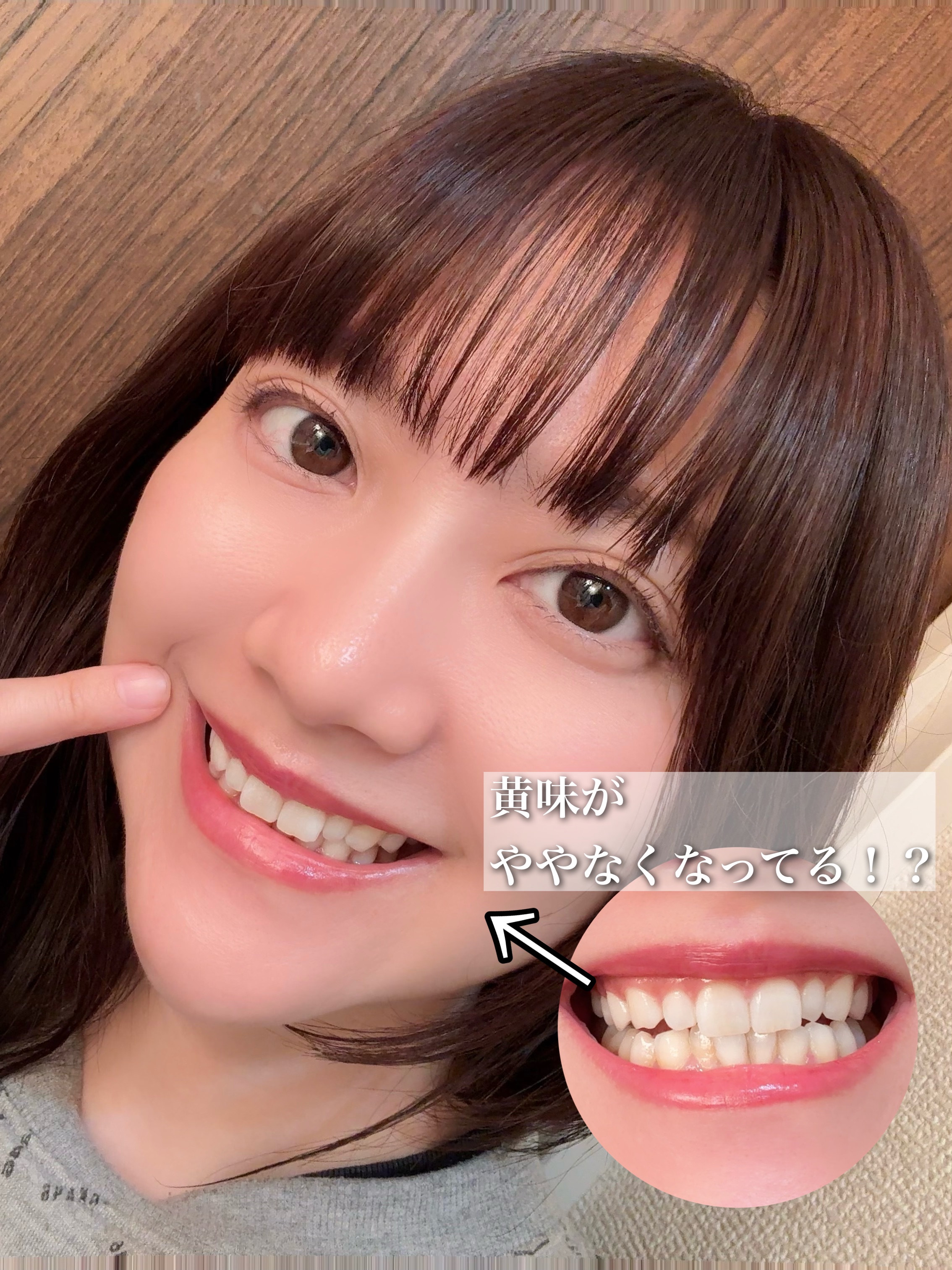 ホワイトパープル歯みがき ピーチフローラルミントの香り/EUTHYMOL/歯磨き粉を使ったクチコミ（3枚目）