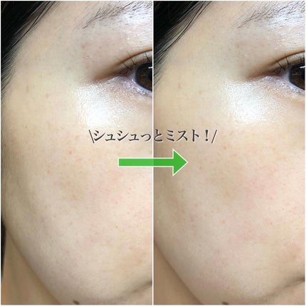 グリーンカーミングセラムミスト/Free Moment /ミスト状化粧水を使ったクチコミ(6枚目)