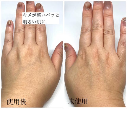 ピンクティーツリーライスシカウォッシュオフパック/APLIN/洗い流すパック・マスクを使ったクチコミ(7枚目)