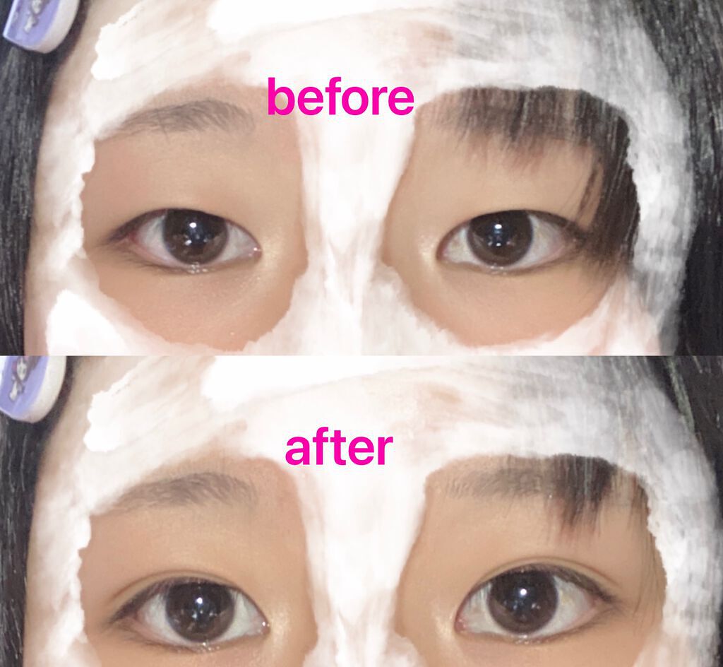 ぱっちり幅広アイテープ/DAISO/二重まぶた用アイテムを使ったクチコミ(2枚目)