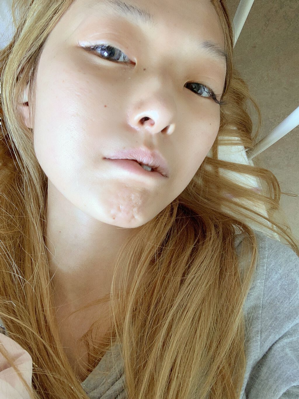 いずにゃん(´ε` )♥フォロバ100 on LIPS 「もろスッピンでも盛ってくれる写メアプリ見っーけ‼️これ今入院中..」(2枚目)