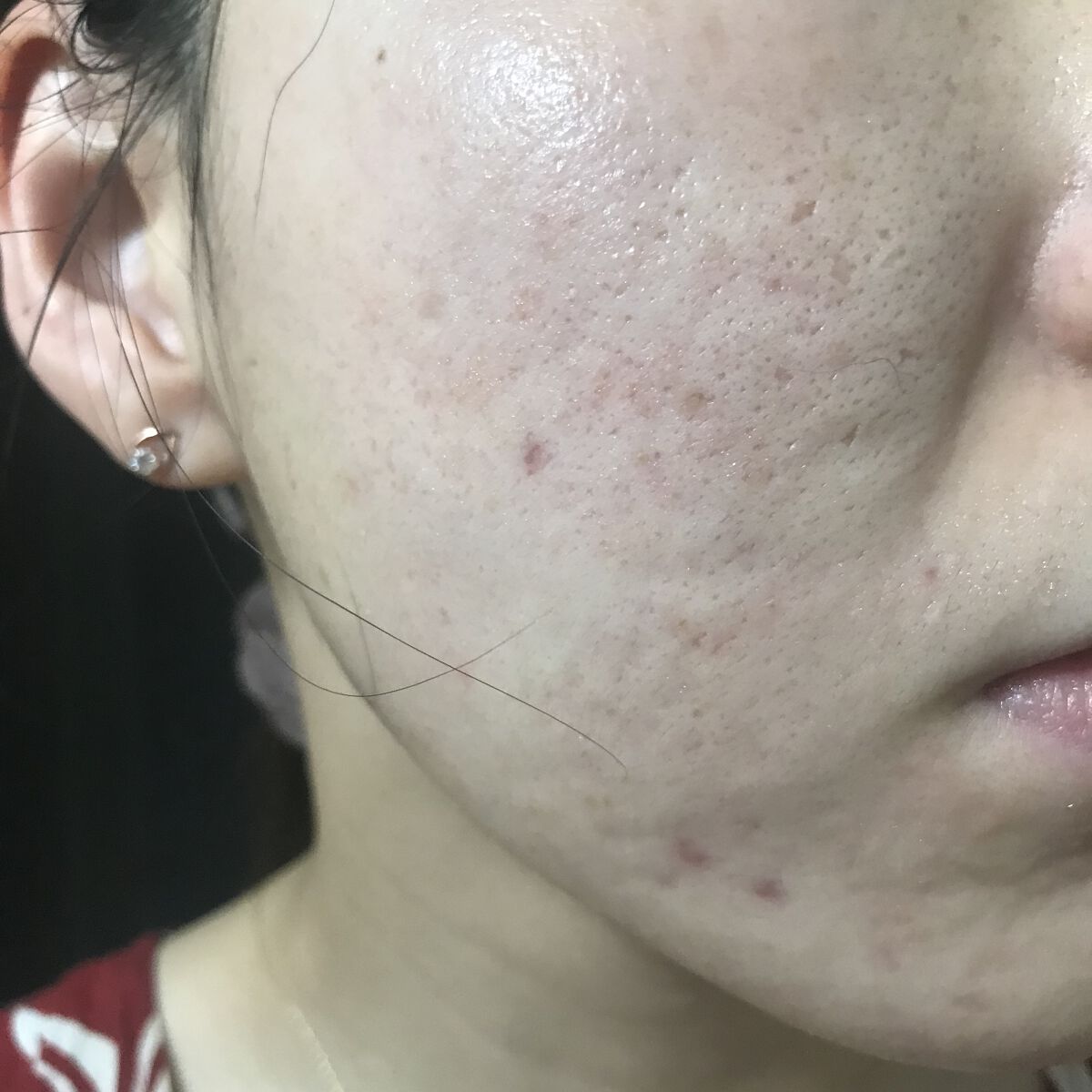 The Ordinary vitamin c suspension 30% in siliconeのクチコミ「7/5(火)の#汚肌工事録
(この日は腸活なし✍️)

\いつも💕ありがとうございます🙏うれし.....」（1枚目）