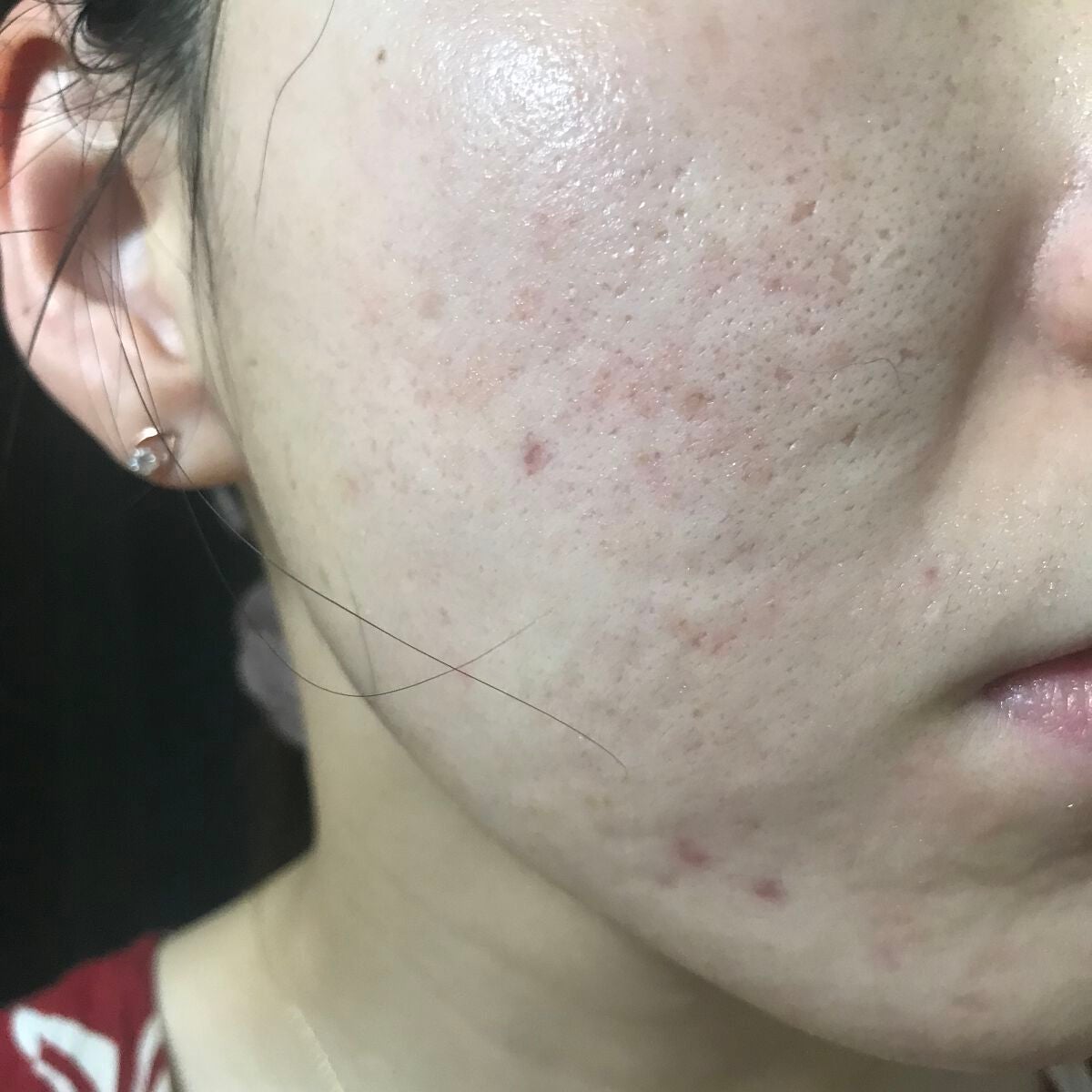 vitamin c suspension 30% in silicone/The Ordinary/美容液を使ったクチコミ(1枚目)