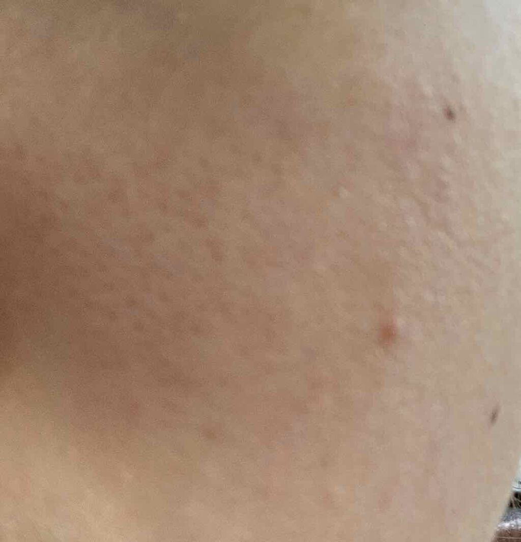 マイルド&モイスチャーアロエジェル/ネイチャーリパブリック/ボディローションを使ったクチコミ(3枚目)