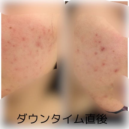 を使ったクチコミ(3枚目)