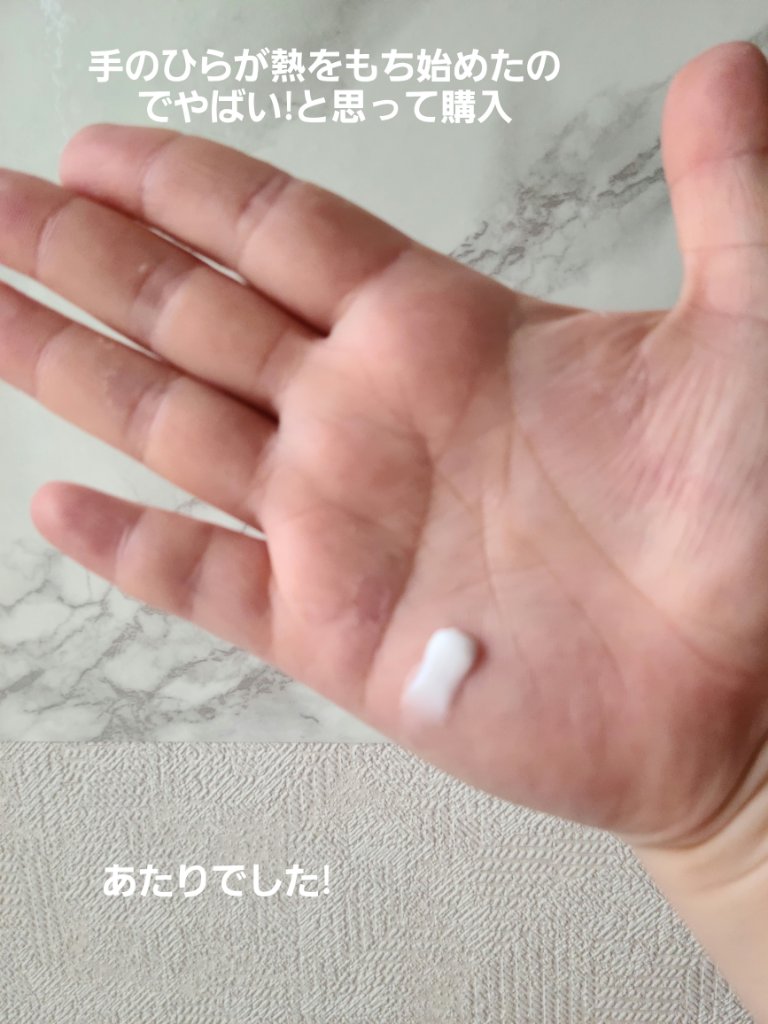 ヘパベールローション（医薬品）/健栄製薬/その他を使ったクチコミ（2枚目）