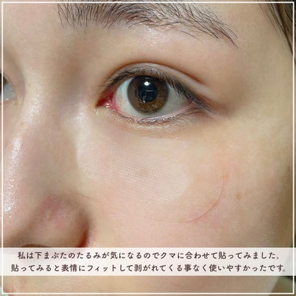 W+ マイクロ ニードル パッチ/SNP/アイケア・アイクリームを使ったクチコミ(6枚目)