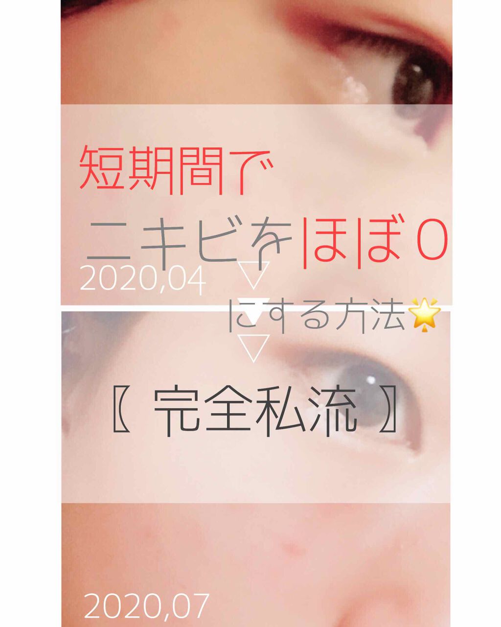 薬用泡のふんわり洗顔/スキンライフ/泡洗顔を使ったクチコミ(1枚目)