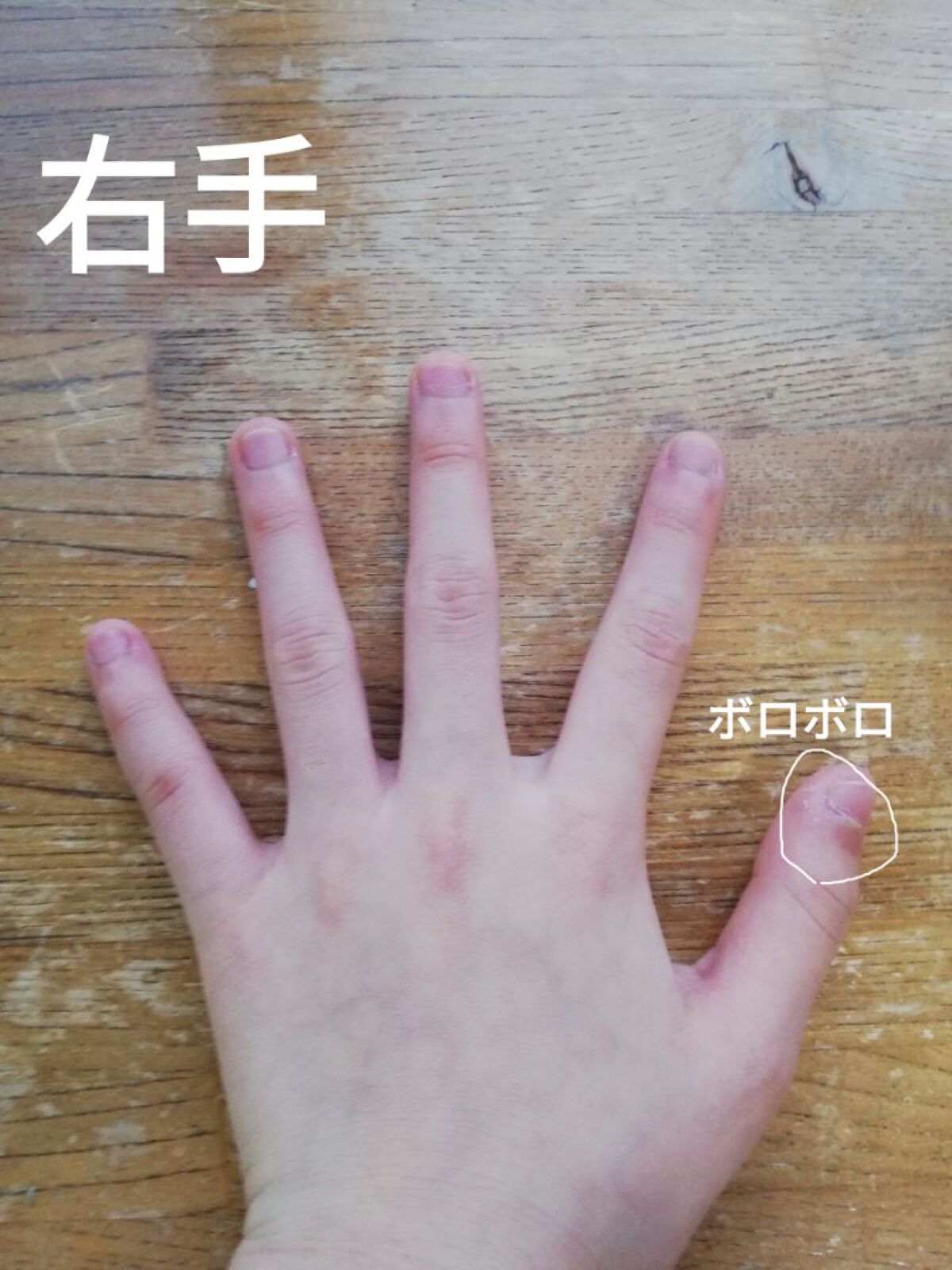 デイケアオイル/Dr.Nail/ネイルオイル・トリートメントを使ったクチコミ(2枚目)