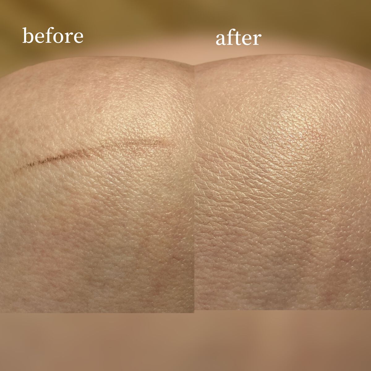 （旧）アンリミテッド ラスティング フルイド/shu uemura/リキッドファンデーションを使ったクチコミ（3枚目）