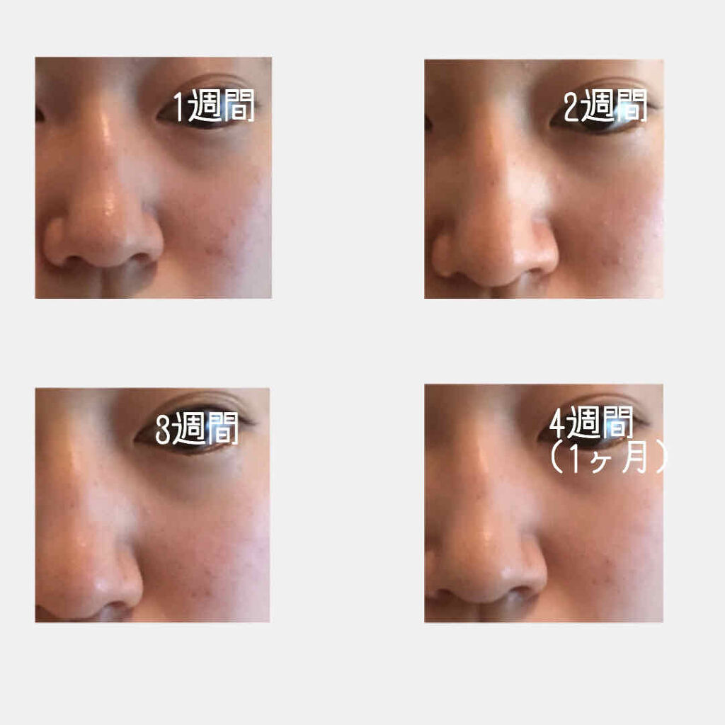 薬用クレンジング洗顔 N/なめらか本舗/洗顔フォームを使ったクチコミ（3枚目）