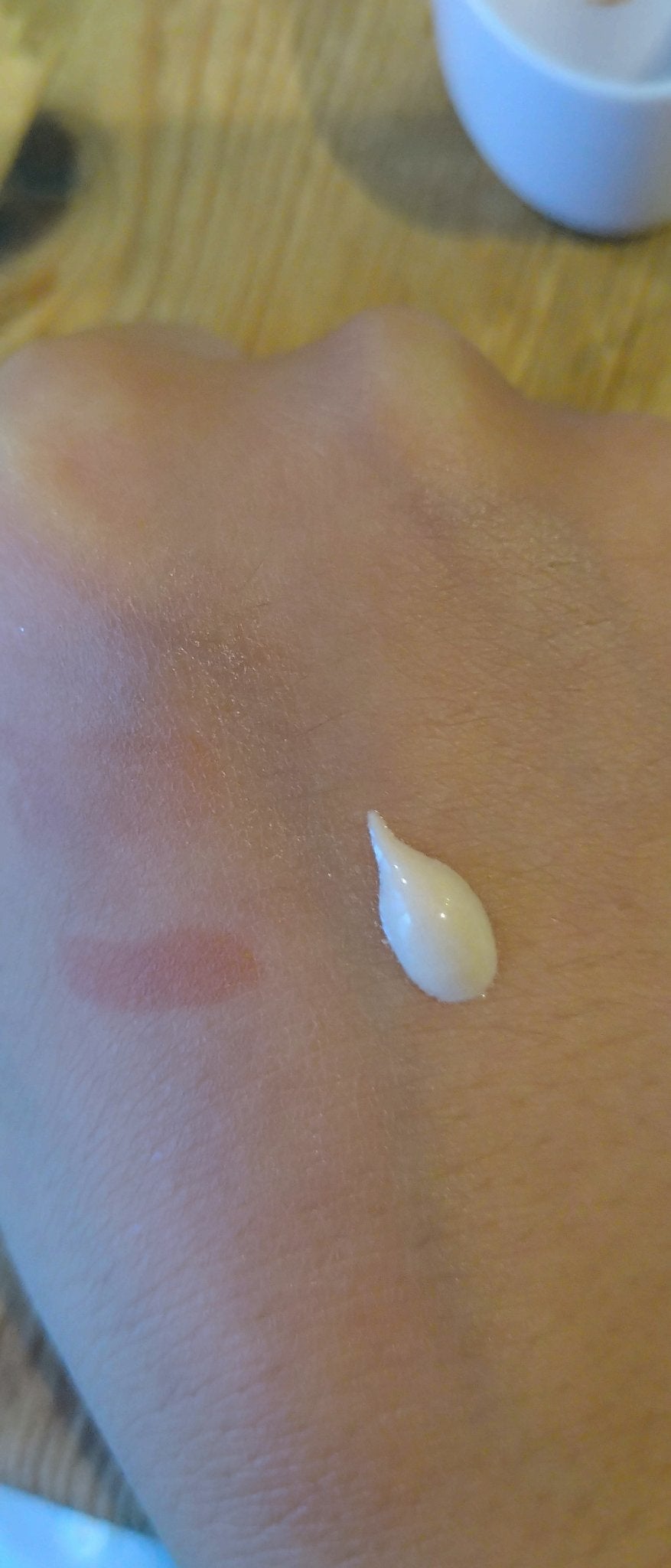 色白研究中! on LIPS 「#夏のお供紹介しますSNSで話題の発症がんの可能性があるスキン..」(5枚目)