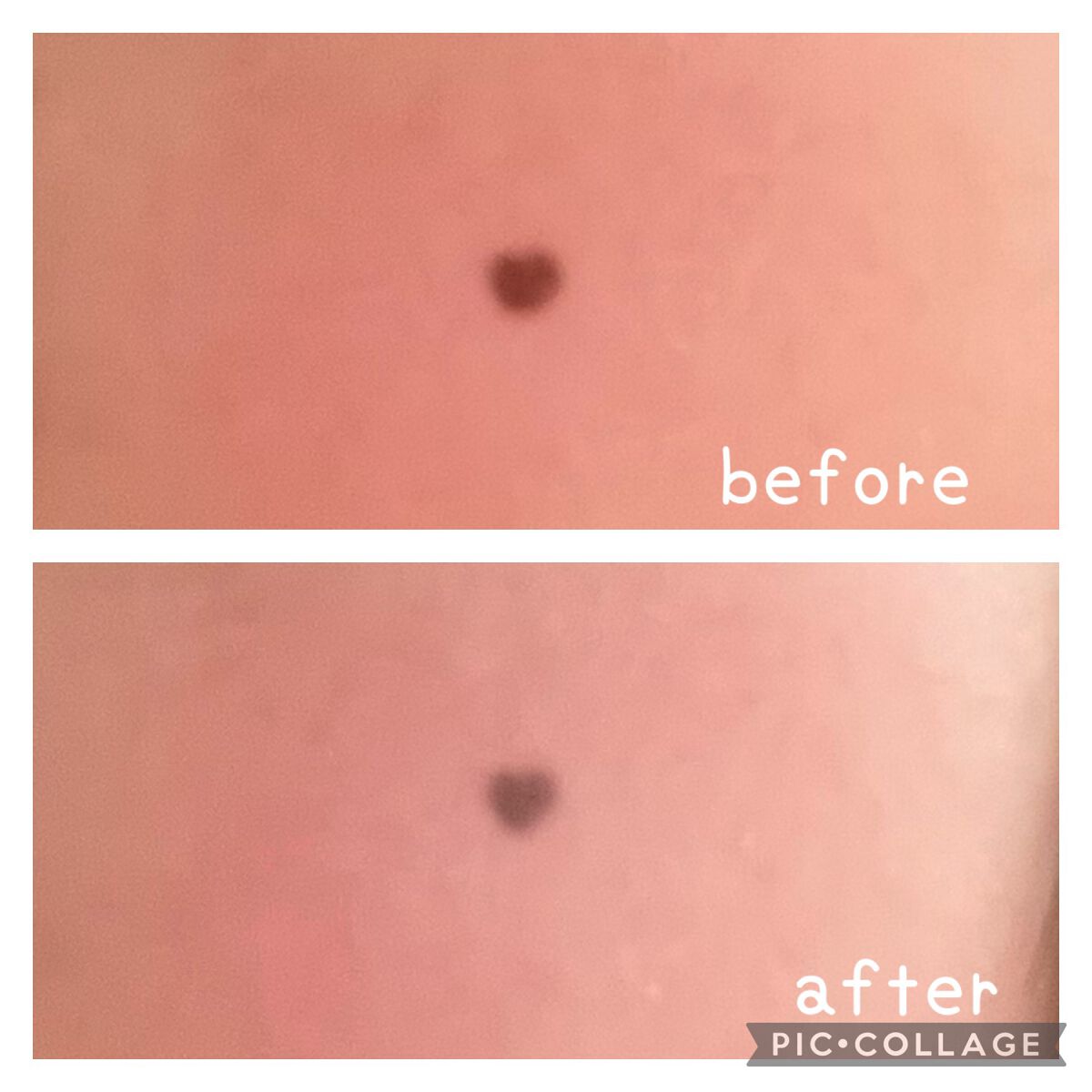 パステルヴェールコンシーラー/キャンメイク/パレットコンシーラーを使ったクチコミ(6枚目)