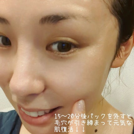 BPマルチスキンケア密着浸透3D美容液パック/Bella Pelle/シートマスク・パックを使ったクチコミ(4枚目)