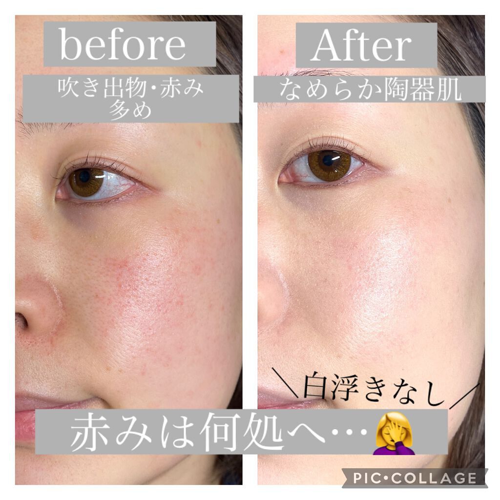 ピンクティーツリーカバークッション/APLIN/クッションファンデーションを使ったクチコミ（3枚目）