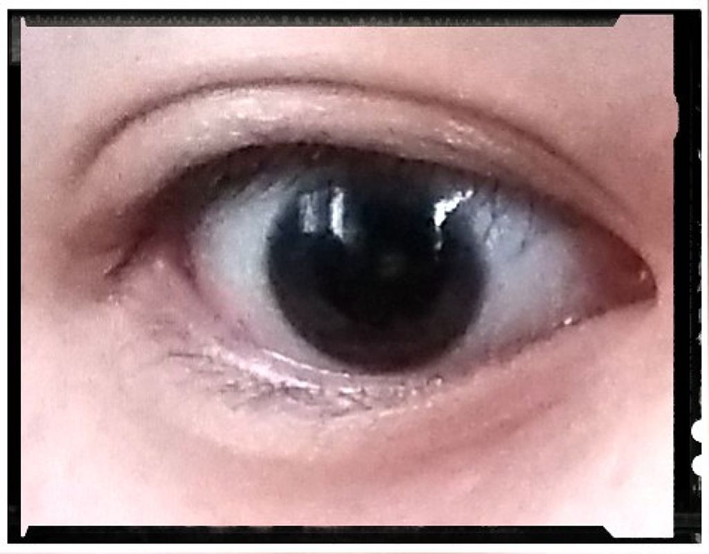 【旧品】オリシキ アイリッドスキンフィルム/D-UP/二重まぶた用アイテムを使ったクチコミ(3枚目)