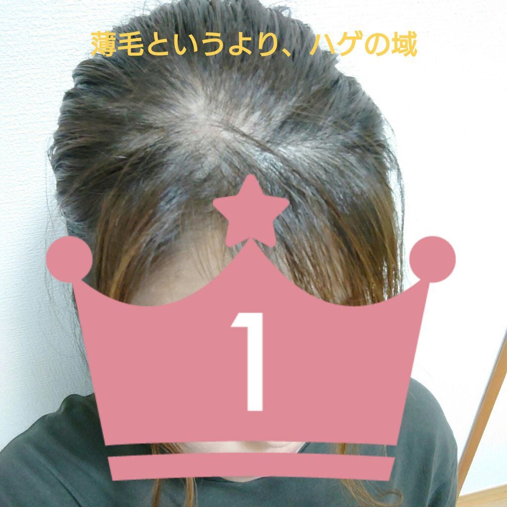 フジコdekoシャドウ/Fujiko/シェーディングを使ったクチコミ(2枚目)