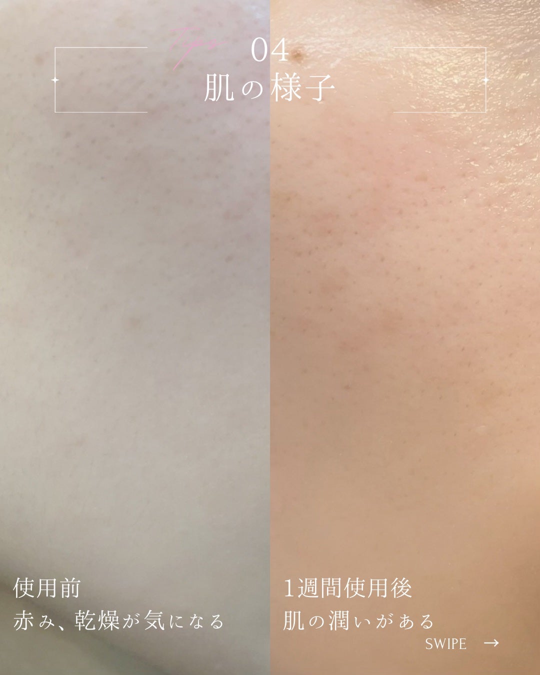 エイシカ365マイクロセラム/AESTURA/美容液を使ったクチコミ(5枚目)