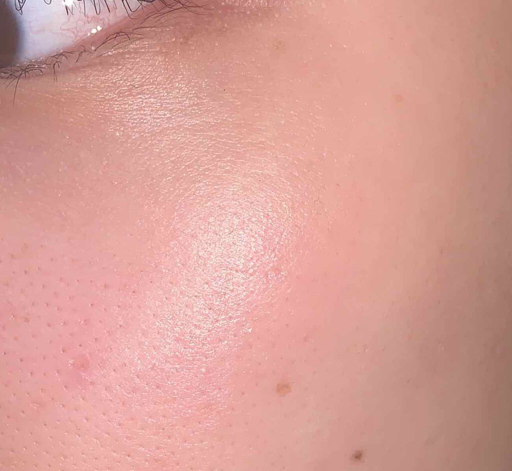 モイストローション/WHOMEE/化粧水を使ったクチコミ（2枚目）