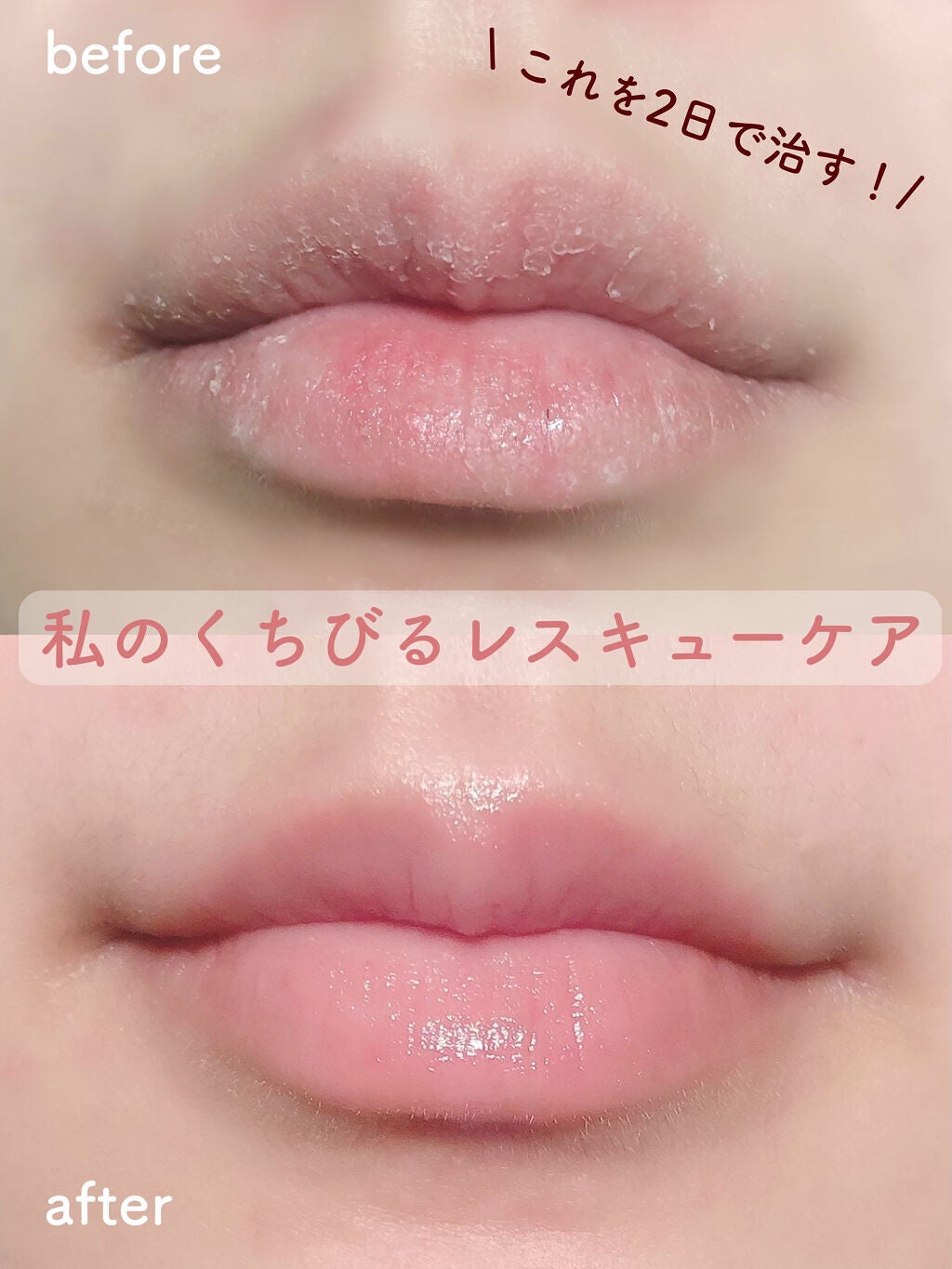 オリジナル ピュアスキンジェリー/ヴァセリン/ボディクリームを使ったクチコミ(1枚目)