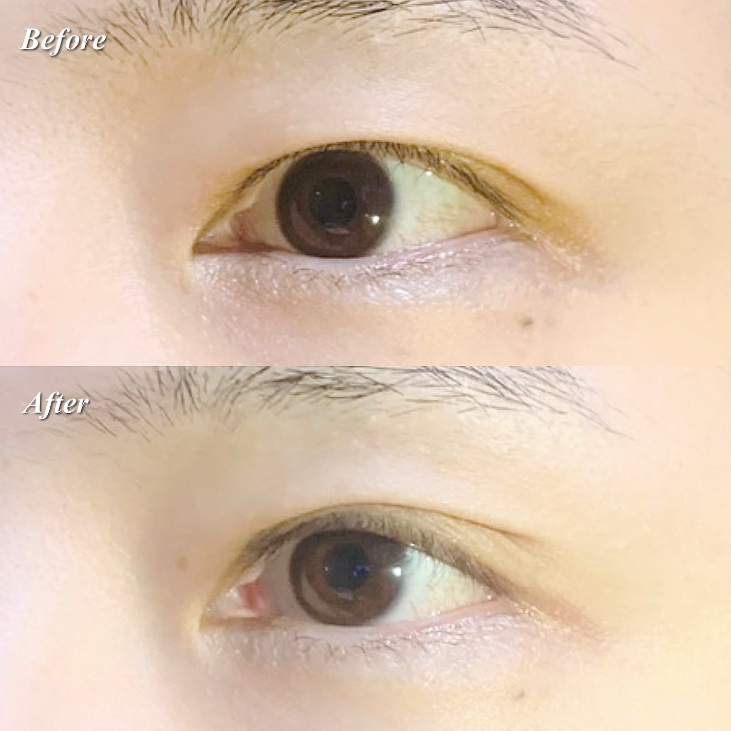 メザイク クリップ カッター ファイバー専用カッター/メザイク/二重まぶた用アイテムを使ったクチコミ(8枚目)