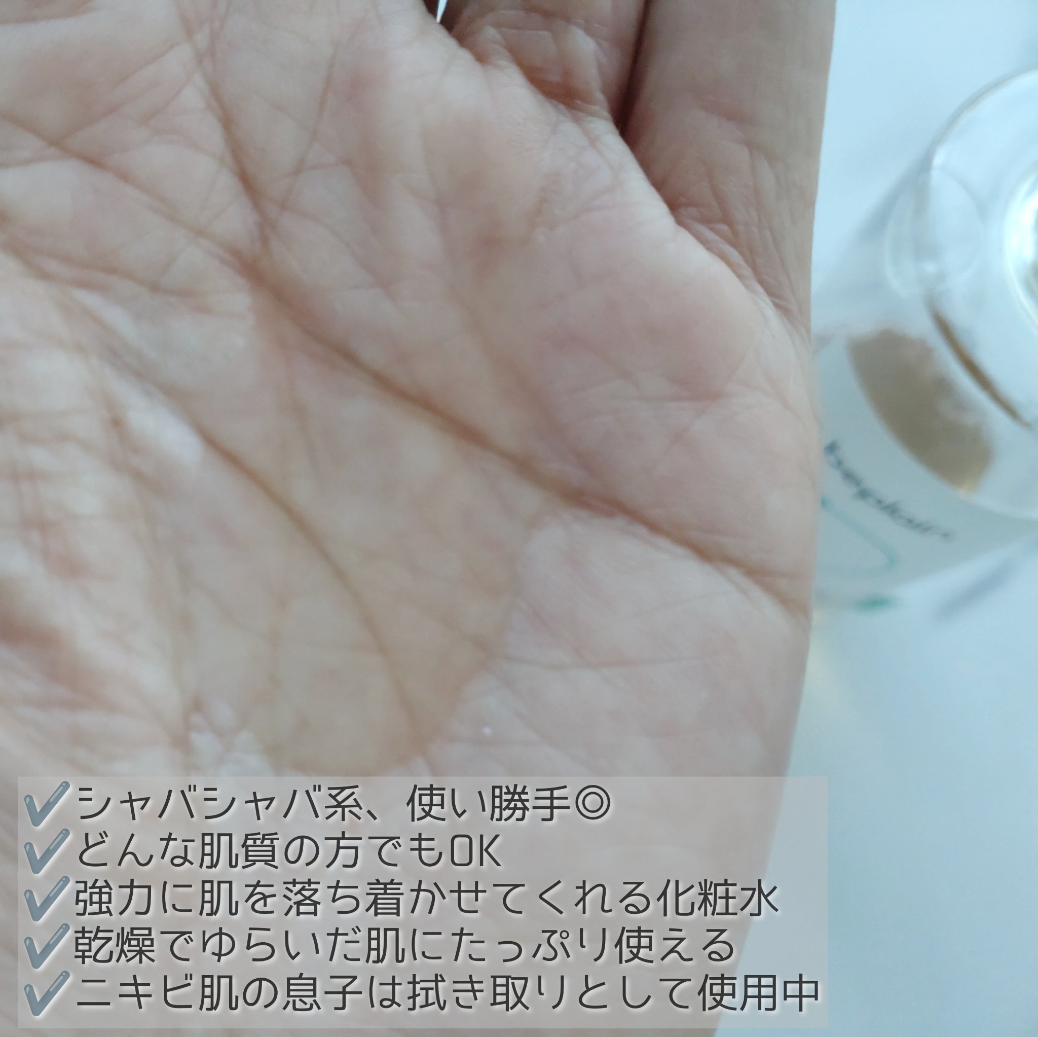 シカテロルトナー/beplain/化粧水を使ったクチコミ（2枚目）