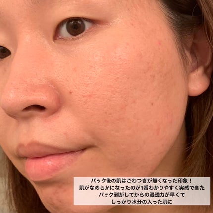 ごめんね素肌マスク/クリアターン/シートマスク・パックを使ったクチコミ(8枚目)