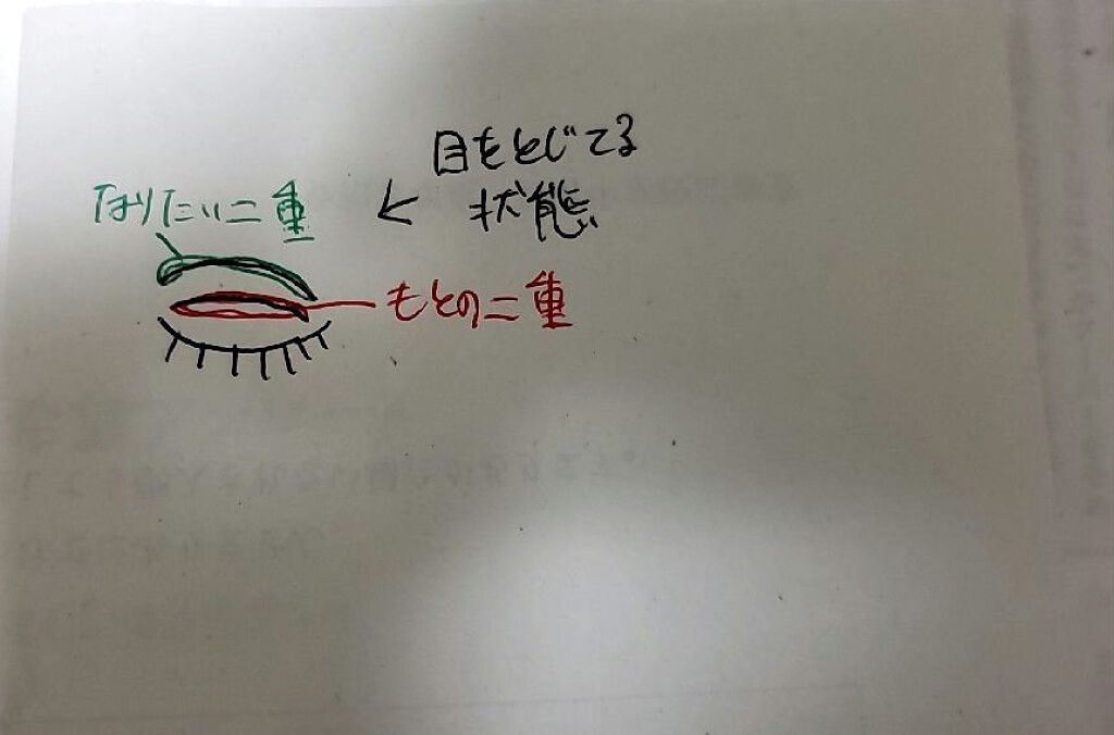 アイビューティー フィクサー WP/アストレア ヴィルゴ/二重まぶた用アイテムを使ったクチコミ（3枚目）