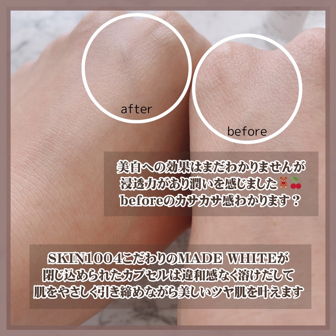 トーンブライトニング カプセルアンプル/SKIN1004/美容液を使ったクチコミ(3枚目)