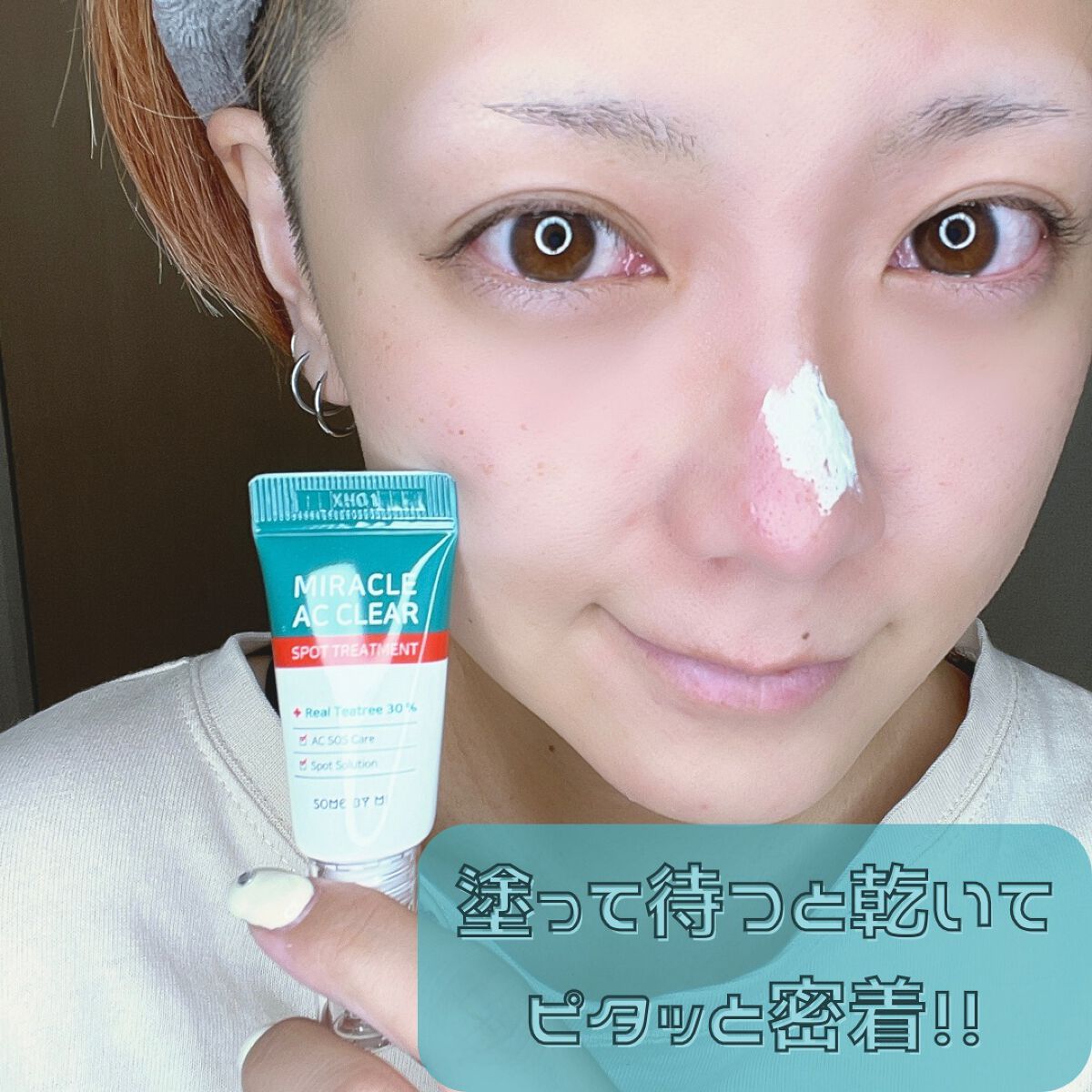 ミラクルアクネクリアスポットトリートメント/SOME BY MI/美容液を使ったクチコミ（2枚目）
