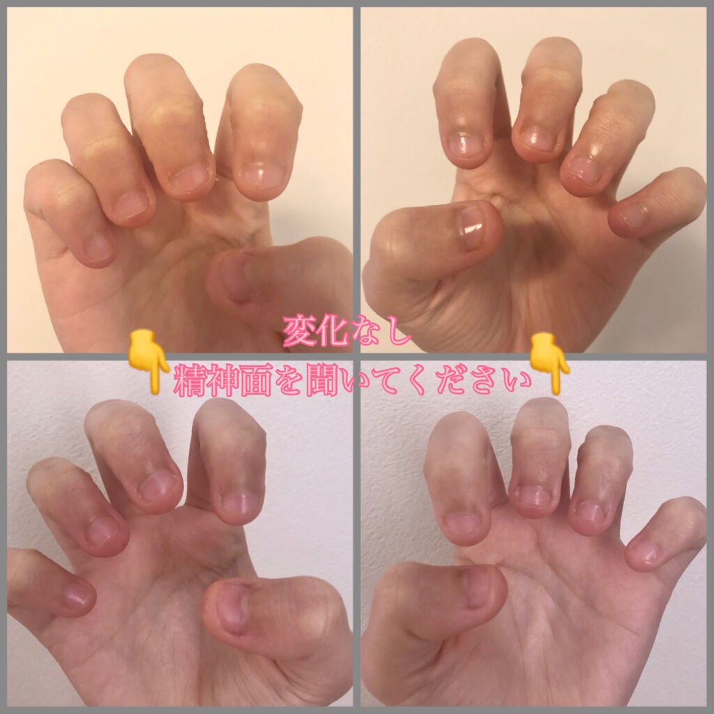 ハンドベール プレミアムリッチネイル/メンソレータム/ネイルオイル・トリートメントを使ったクチコミ(4枚目)