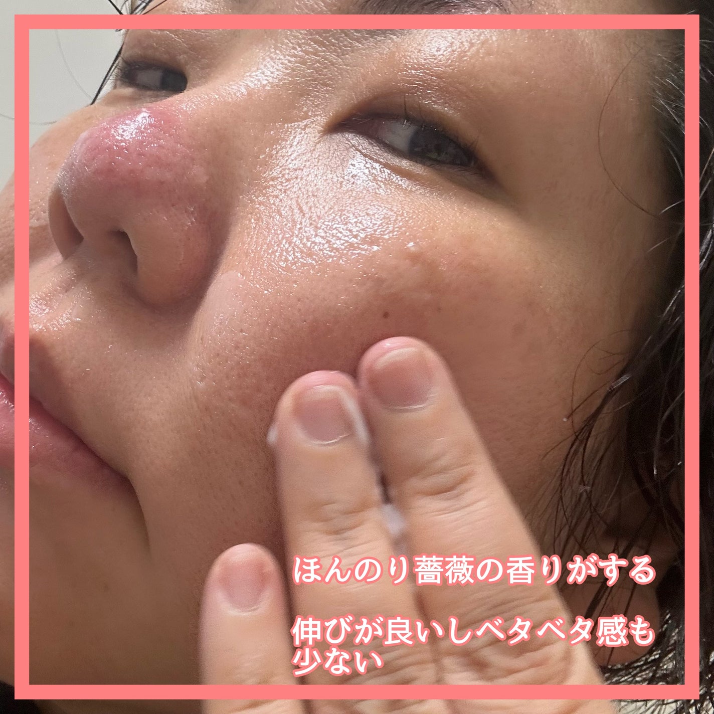 マデセラクリーム/SKINRx LAB/フェイスクリームを使ったクチコミ(3枚目)