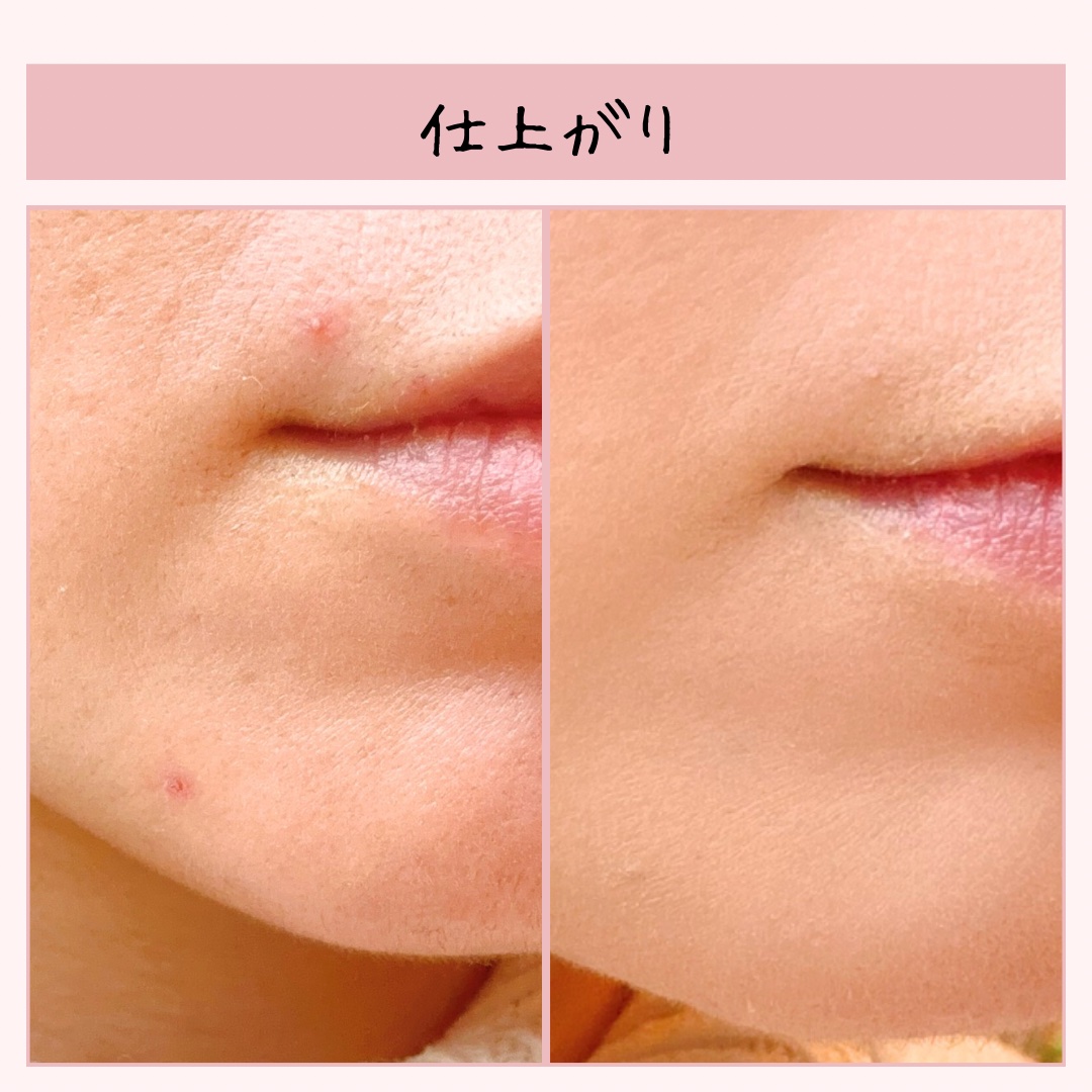 カバーパーフェクション チップコンシーラー 1.25 ライトベージュ/the SAEM/リキッドコンシーラーを使ったクチコミ（3枚目）