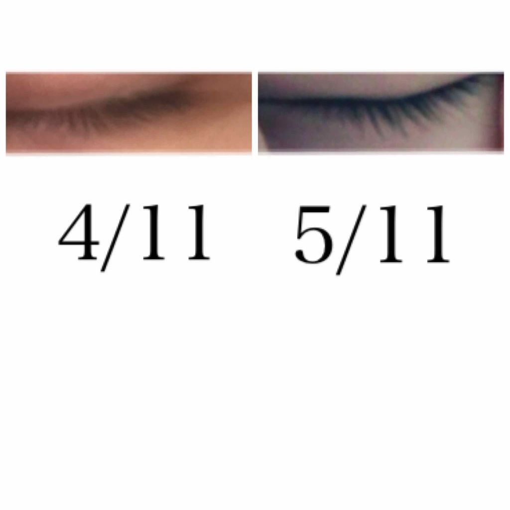ã¹ã«ã«ãD ããŒã ãã¥ã¢ããªãŒã¢ã€ã©ãã·ã¥ã»ã©ã /ã¢ã³ãã¡ãŒ(ã¹ã«ã«ãD)/ãŸã€ãçŸå®¹æ¶²ã䜿ã£ãã¯ãã³ãïŒ2æç®ïŒ