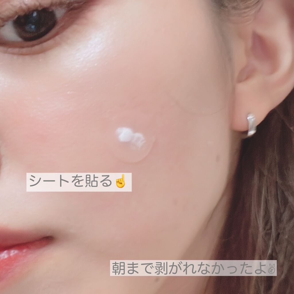 薬用ニキビケア スポッツクリーム/アクネスラボ/フェイスクリームを使ったクチコミ(5枚目)