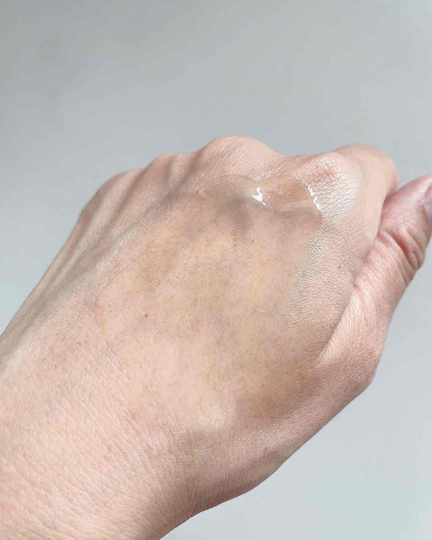 ブレミッシュケアアップ セラム/ISOI/美容液を使ったクチコミ(5枚目)