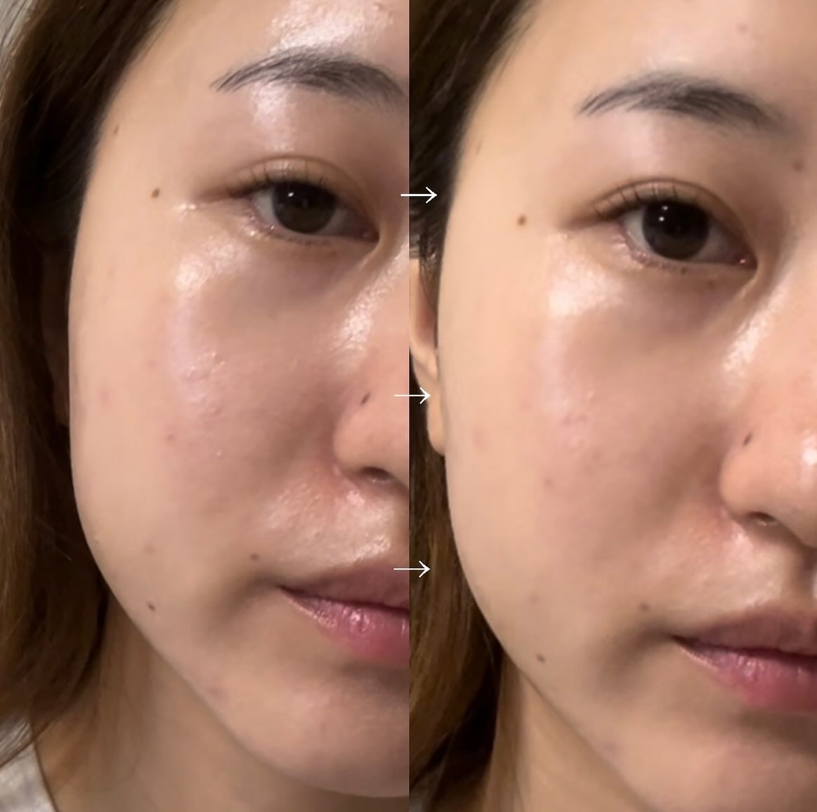 チャコット フィニッシングパウダー モイスト/チャコット・コスメティクス/ルースパウダーを使ったクチコミ（3枚目）