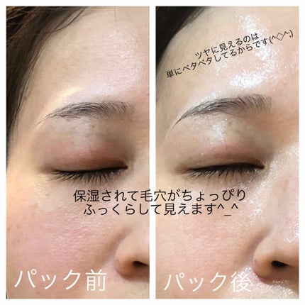 オールインワンシートマスク ホワイトEX/クオリティファースト/シートマスク・パックを使ったクチコミ(4枚目)