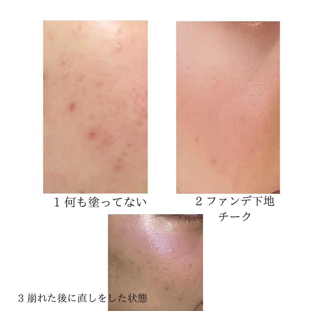 ピンクティーツリーカバークッション/APLIN/クッションファンデーションを使ったクチコミ（2枚目）